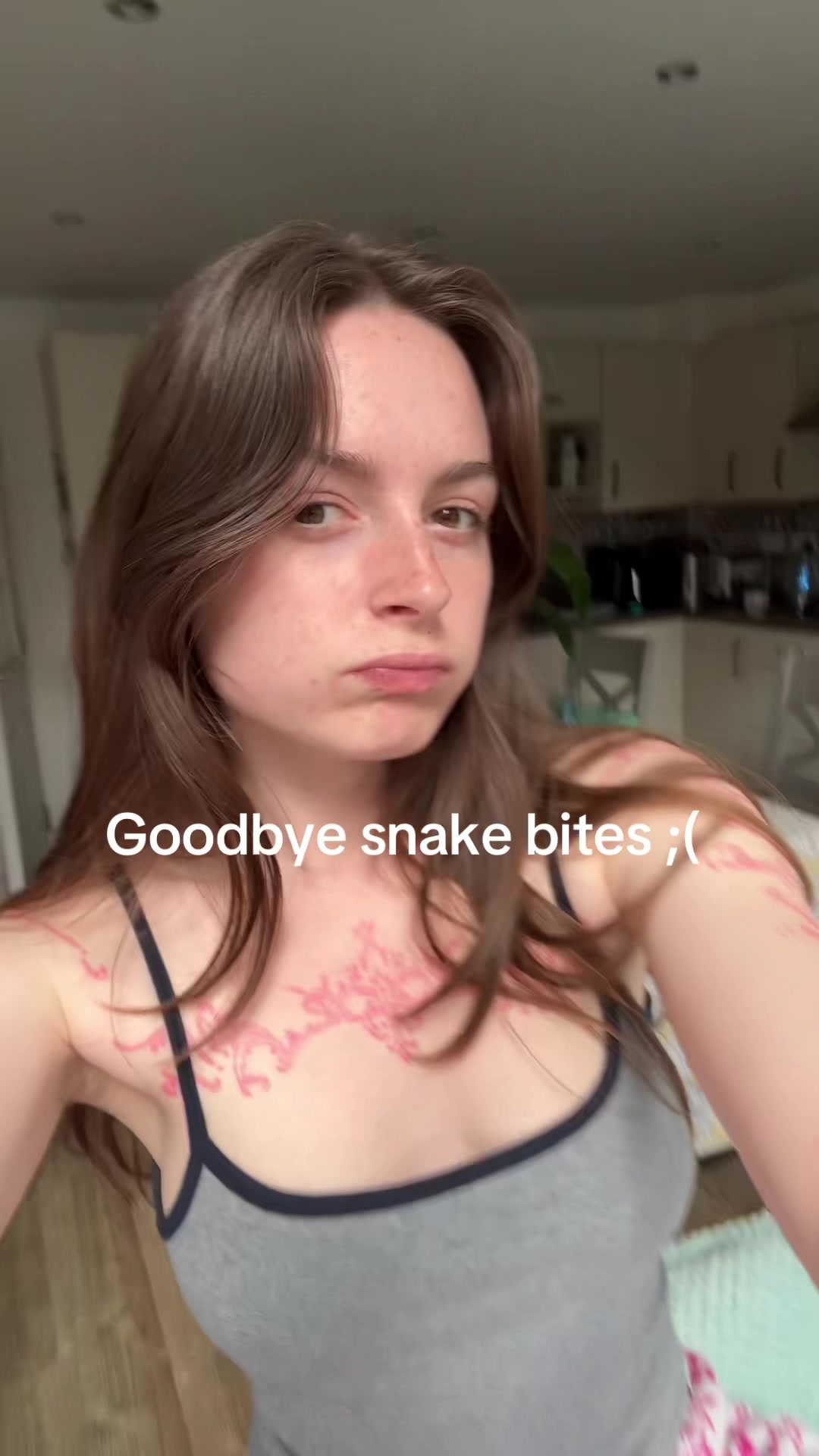 @Evie