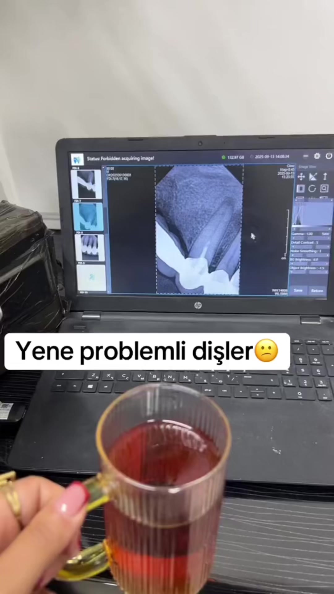 @Dentist_Günel