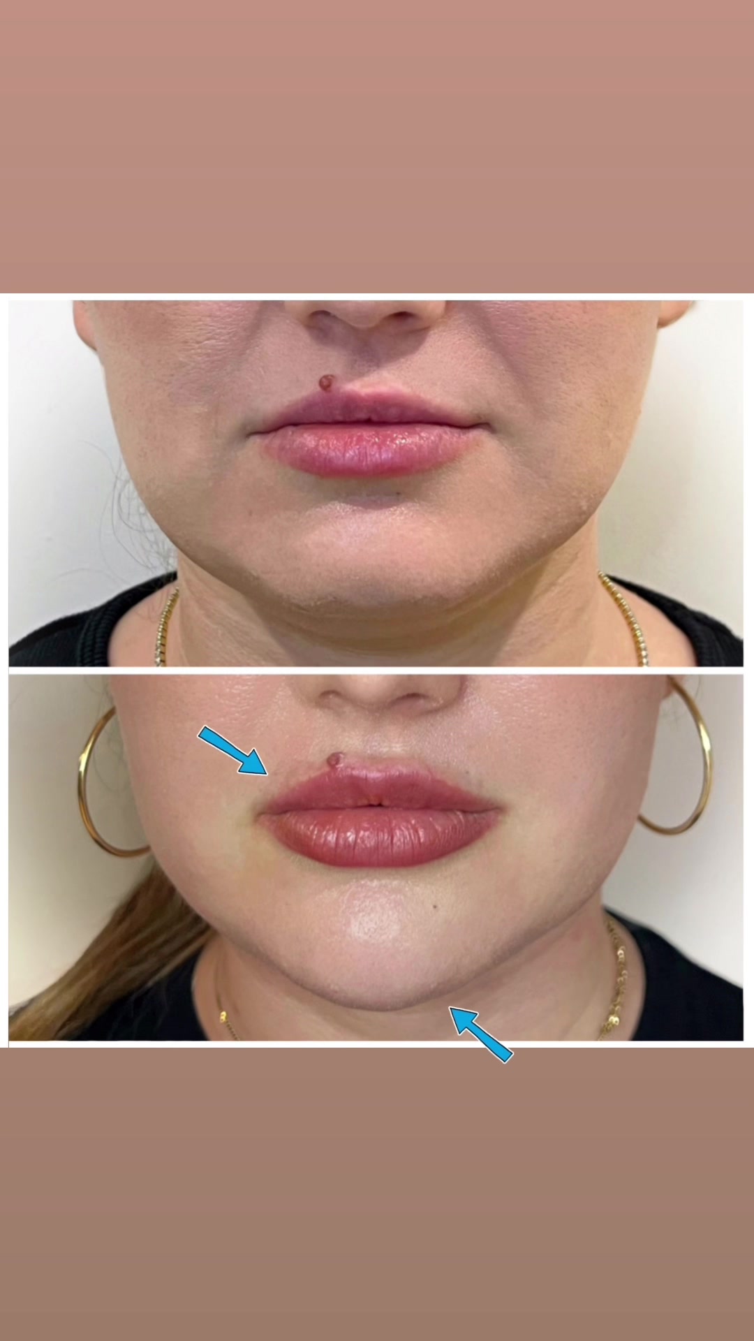 @facesbyroberto