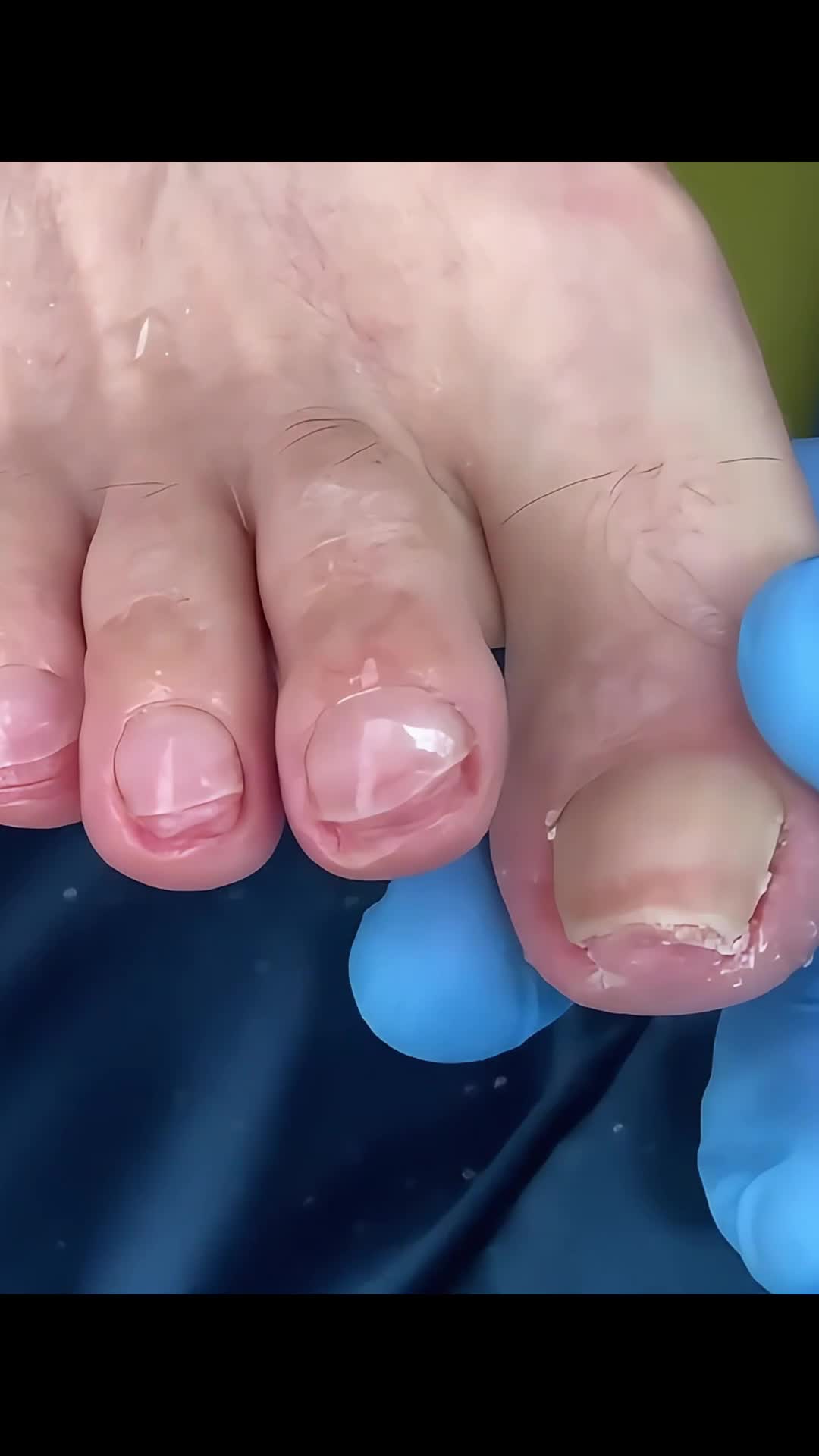 @Toenails.clips
