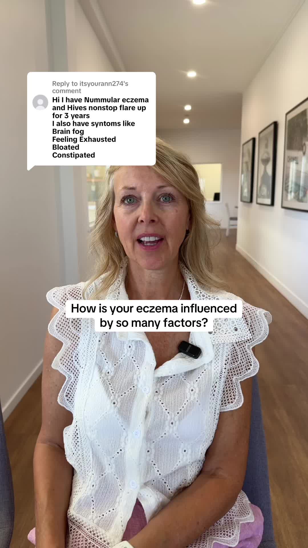 @Eczema Diaries USA & UK