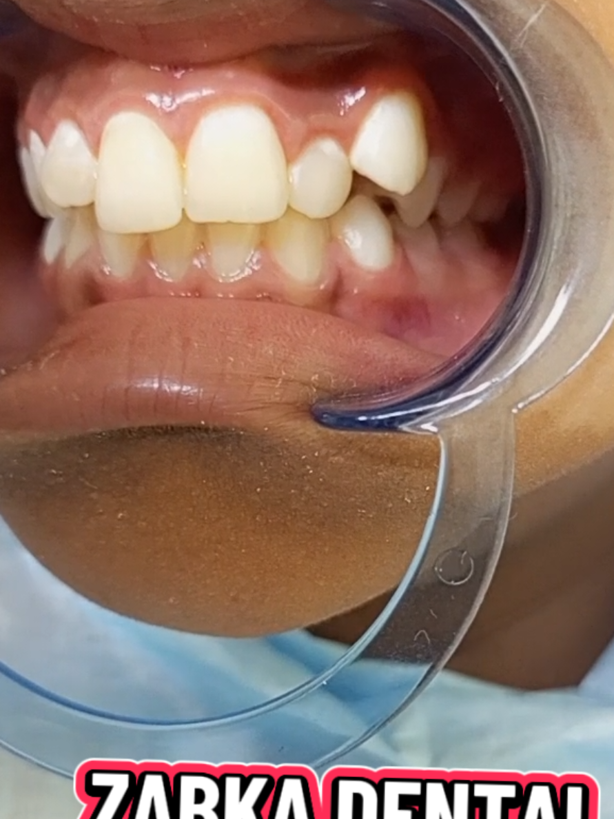 @Zabka Dental