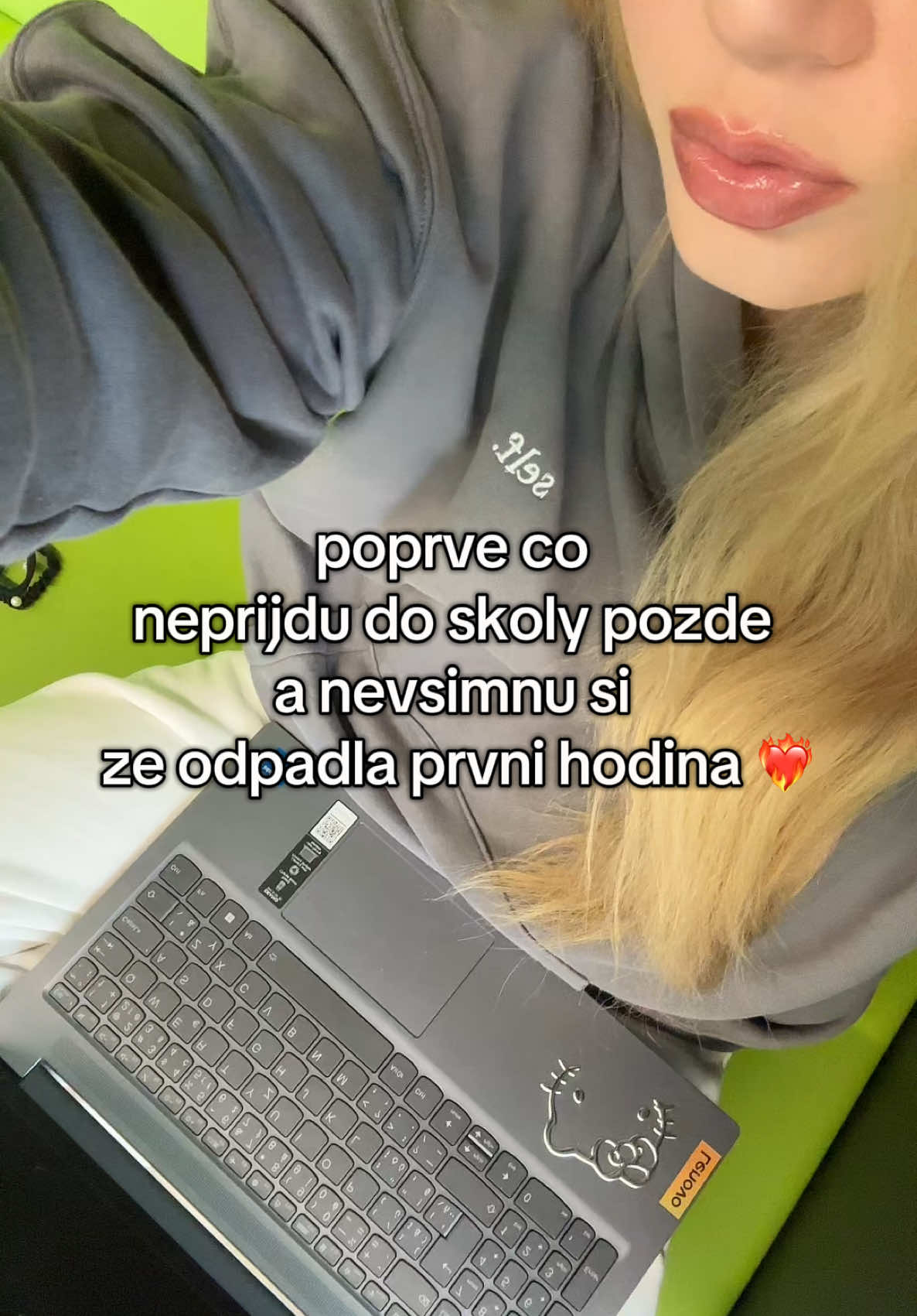 @misa