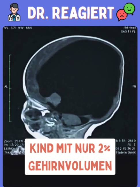 @Hand, Fuß, Mund