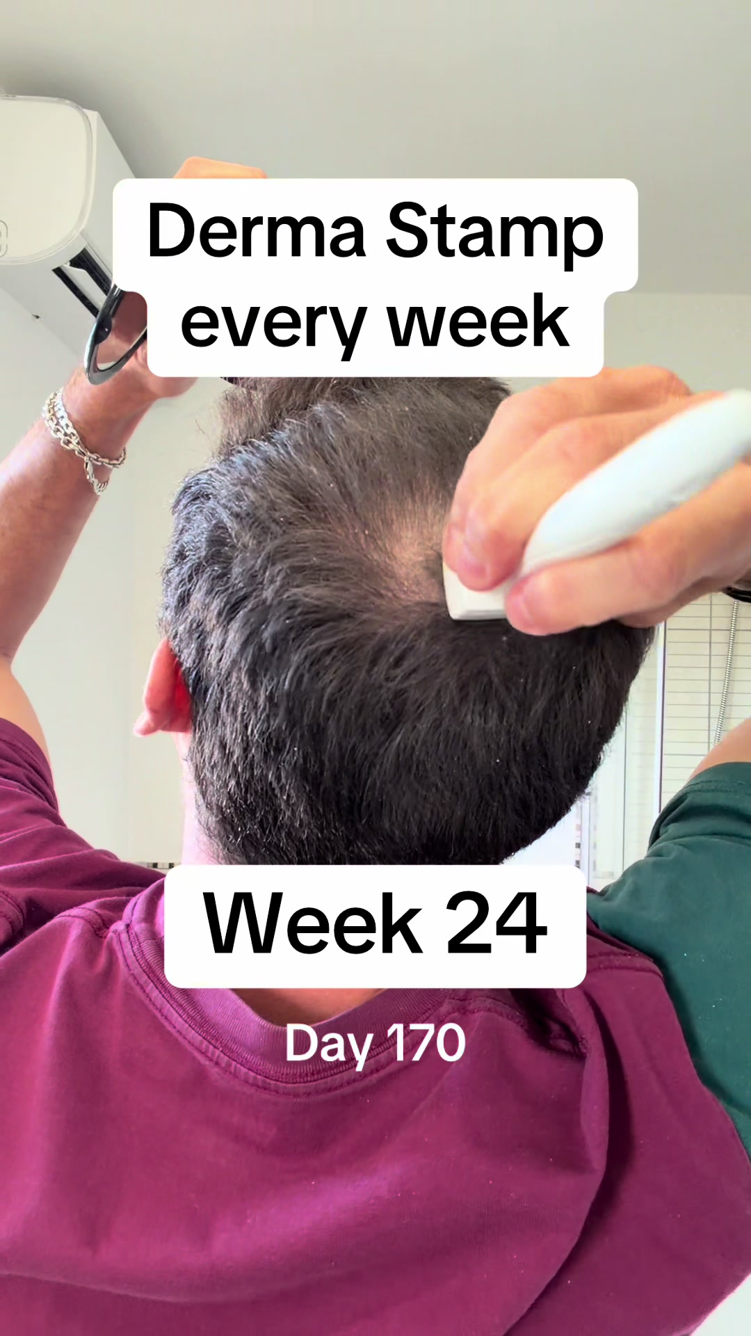@scalp.hero
