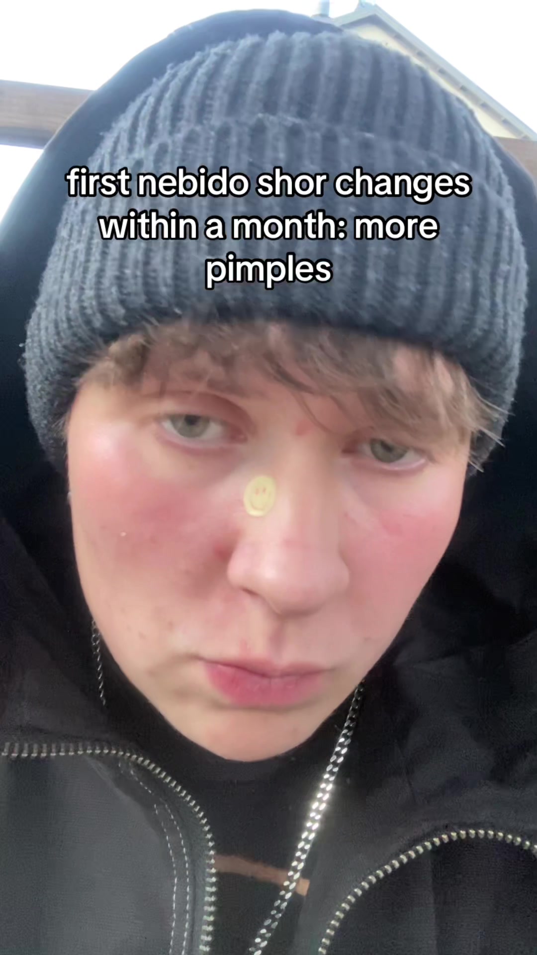 @Fffvccc