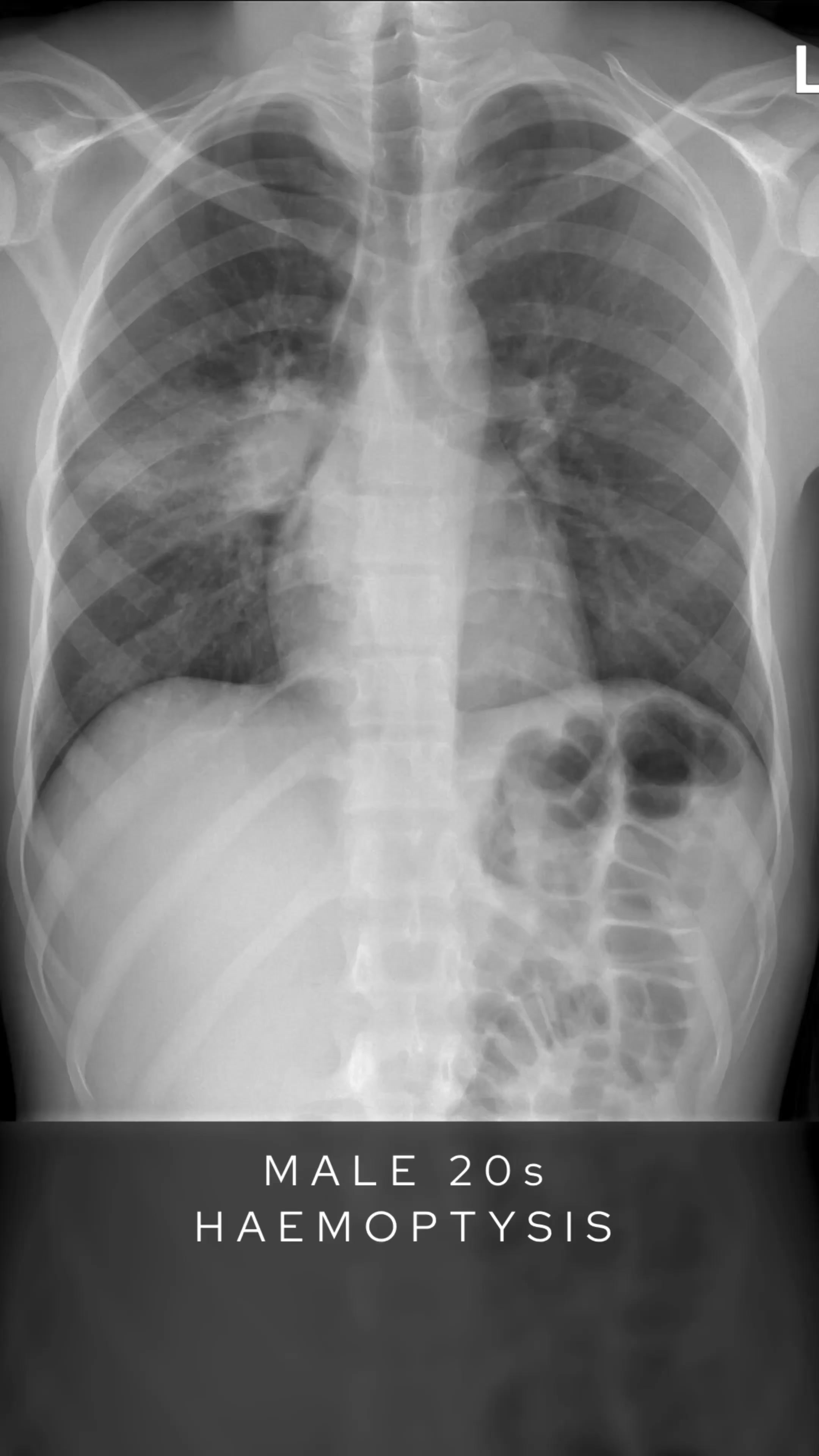 @The Radiologist