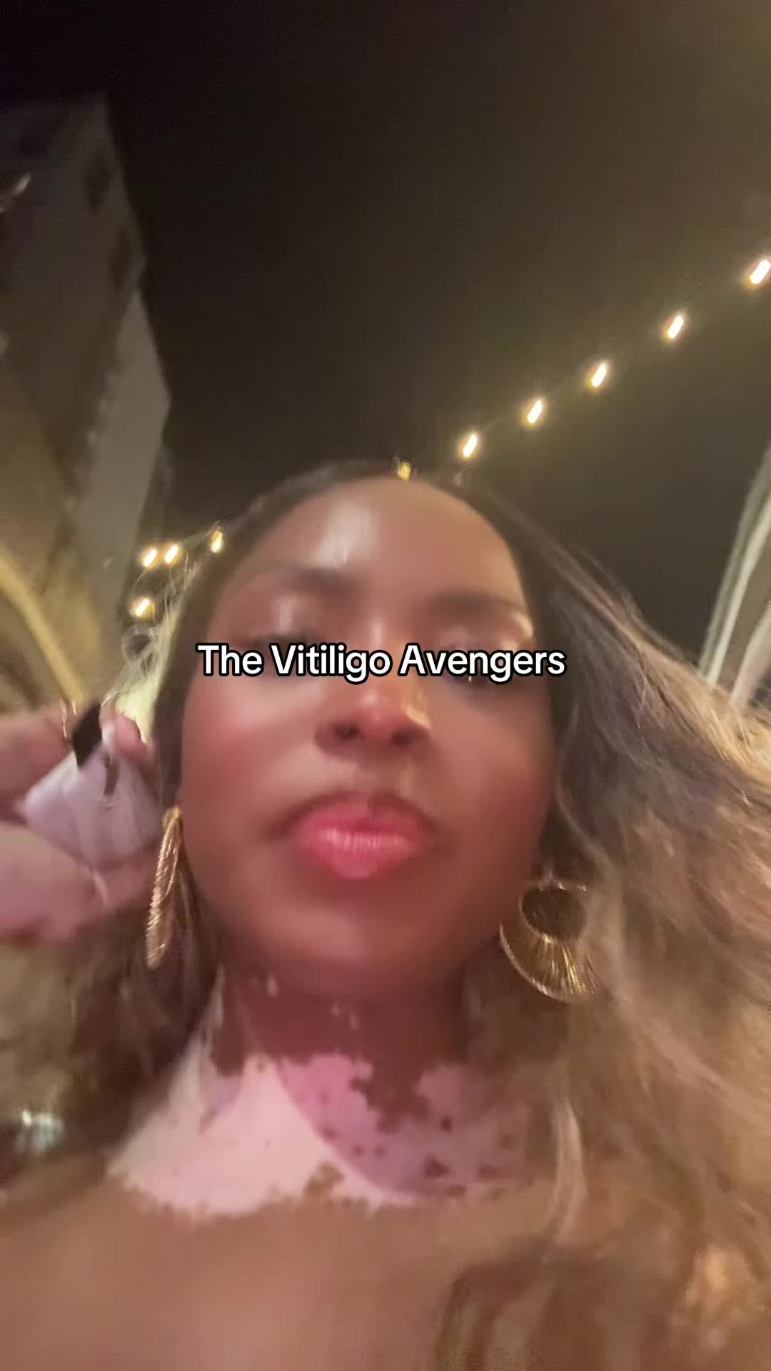 @VitiligoFairy