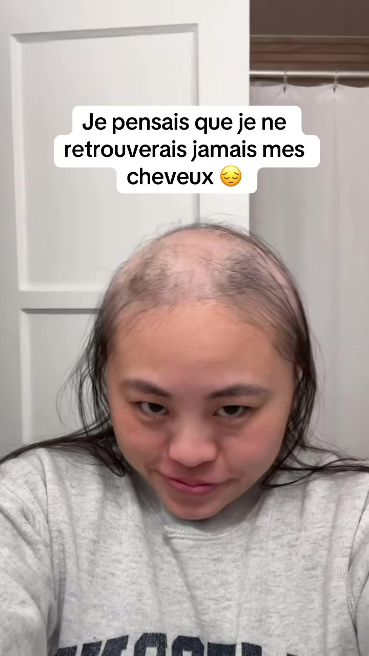 @Lux&rsquo;Hair Growth