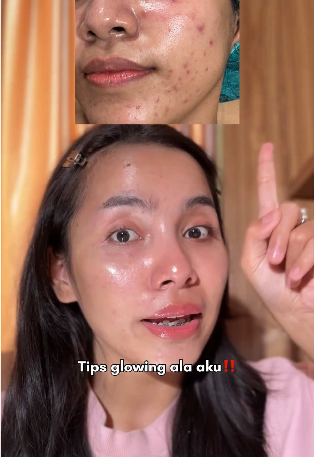 @Deenish_