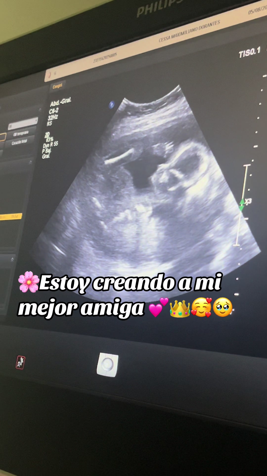 @Dulce Ruiz