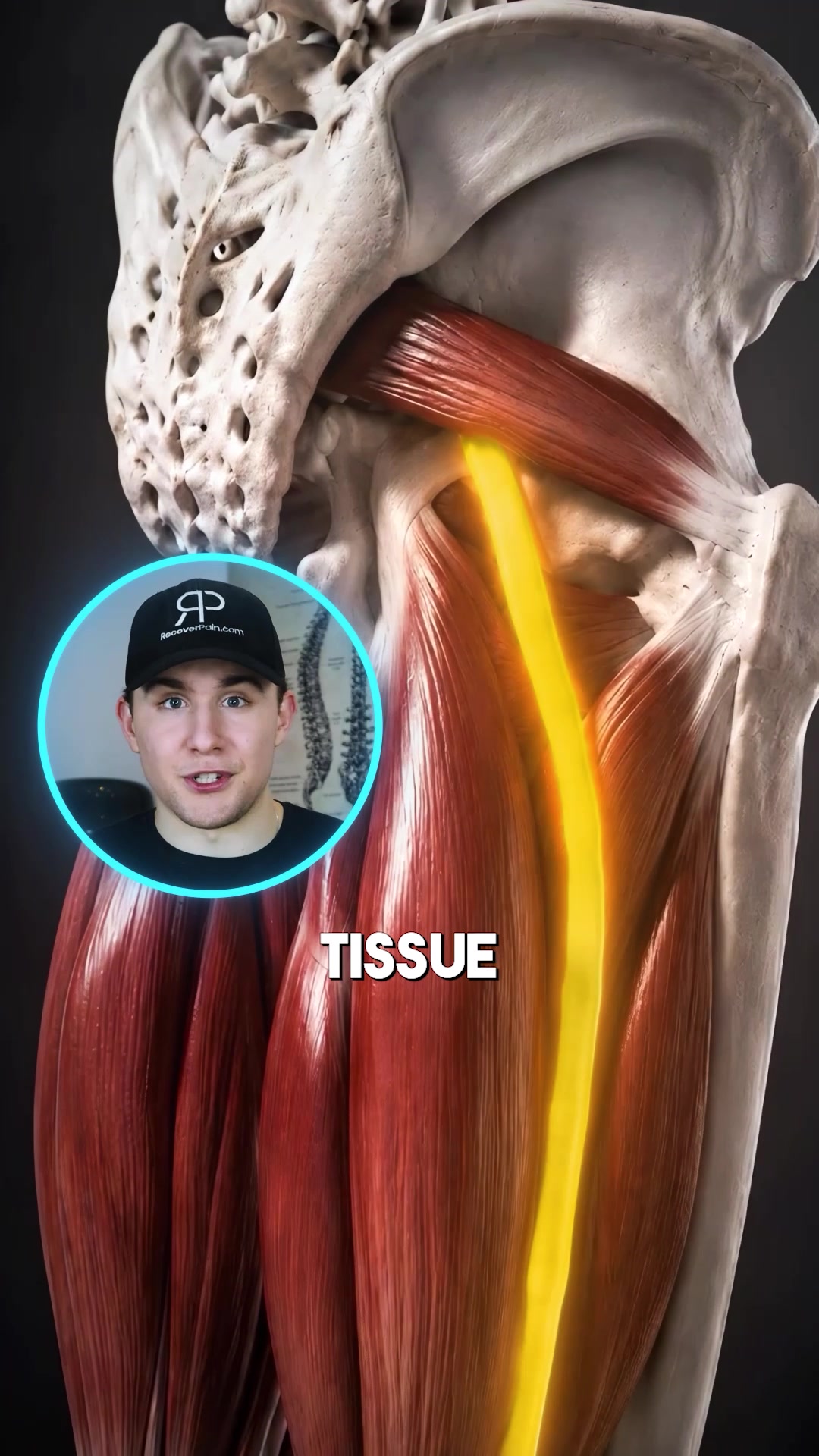 @Recover Pain