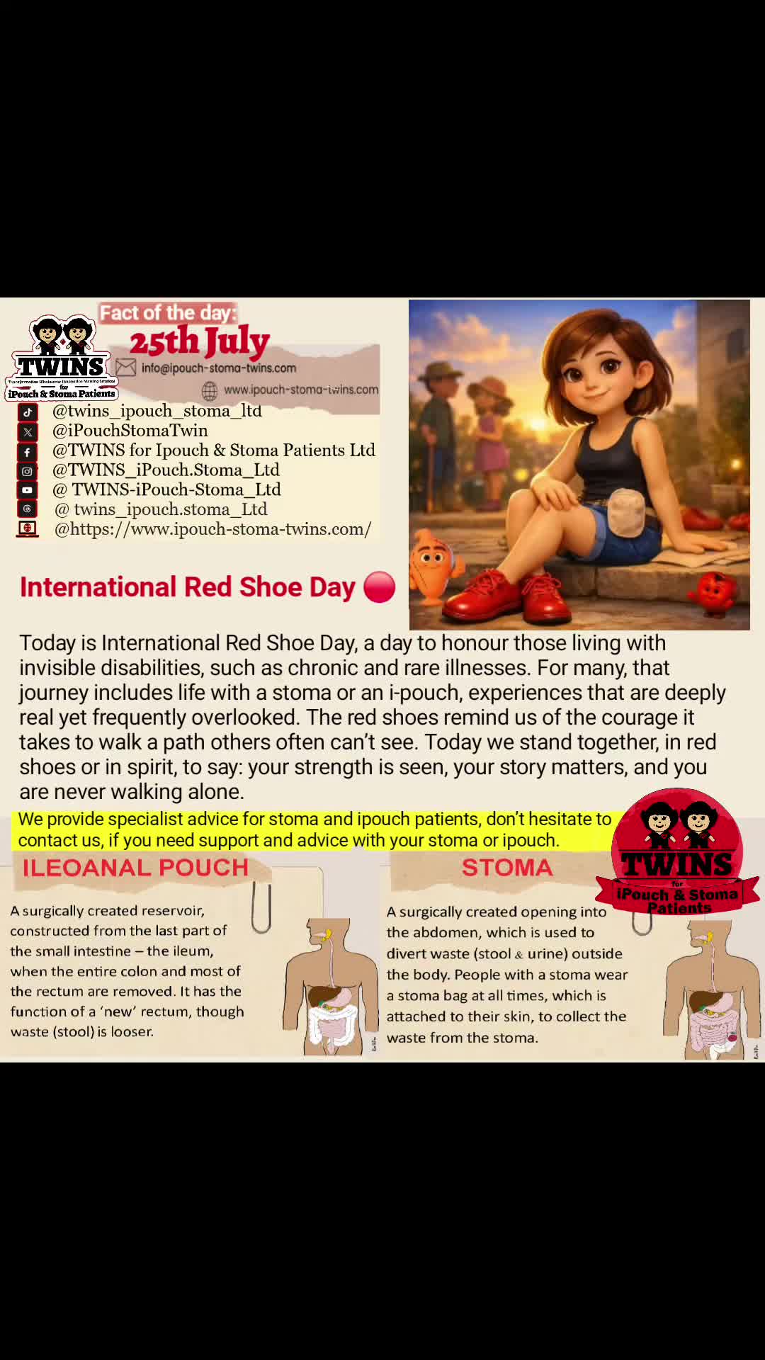 @TWINS_iPouch_Stoma_Ltd