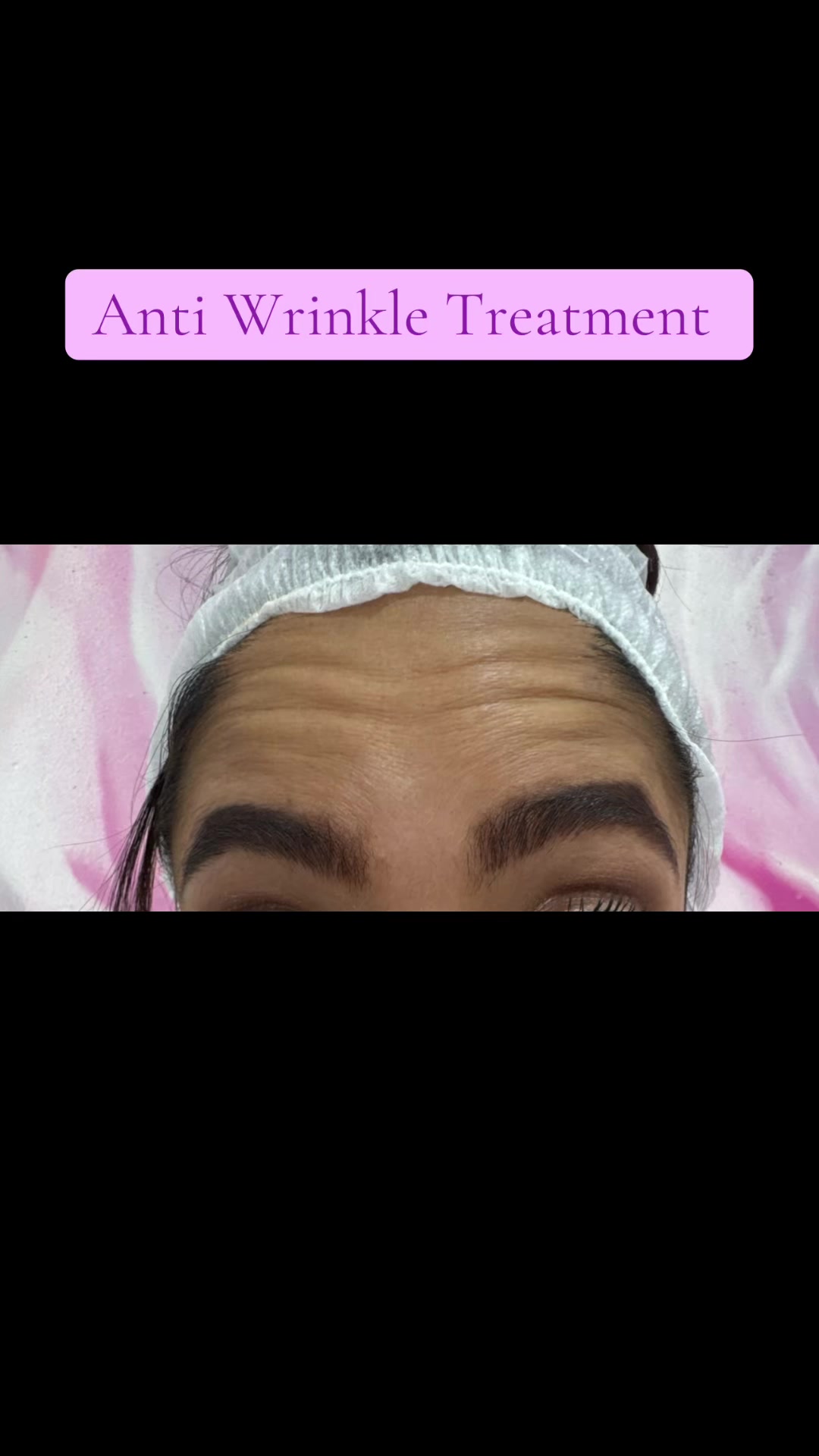 @The Facebysk