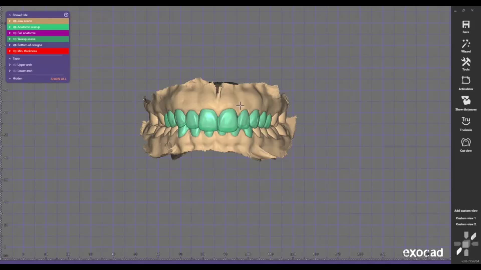 @Vivo Dental Lab