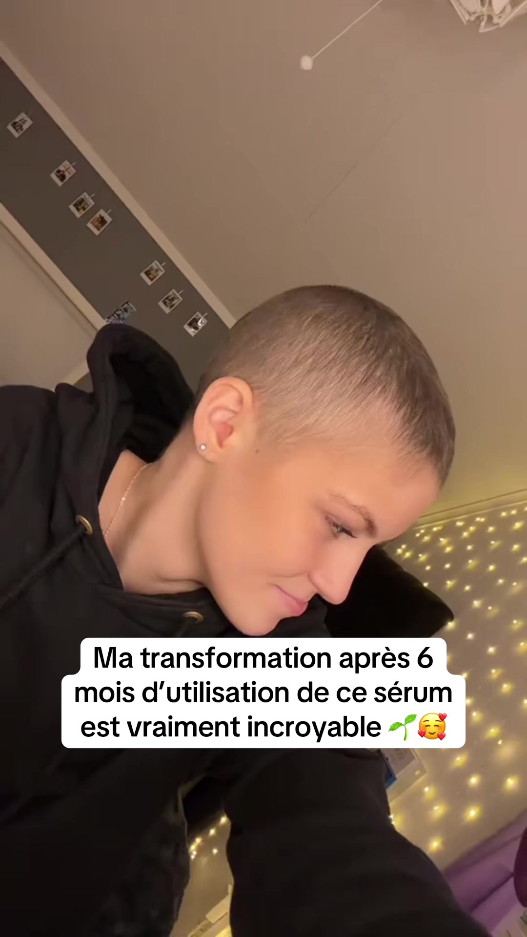 @Lux&rsquo;Hair Growth Paris