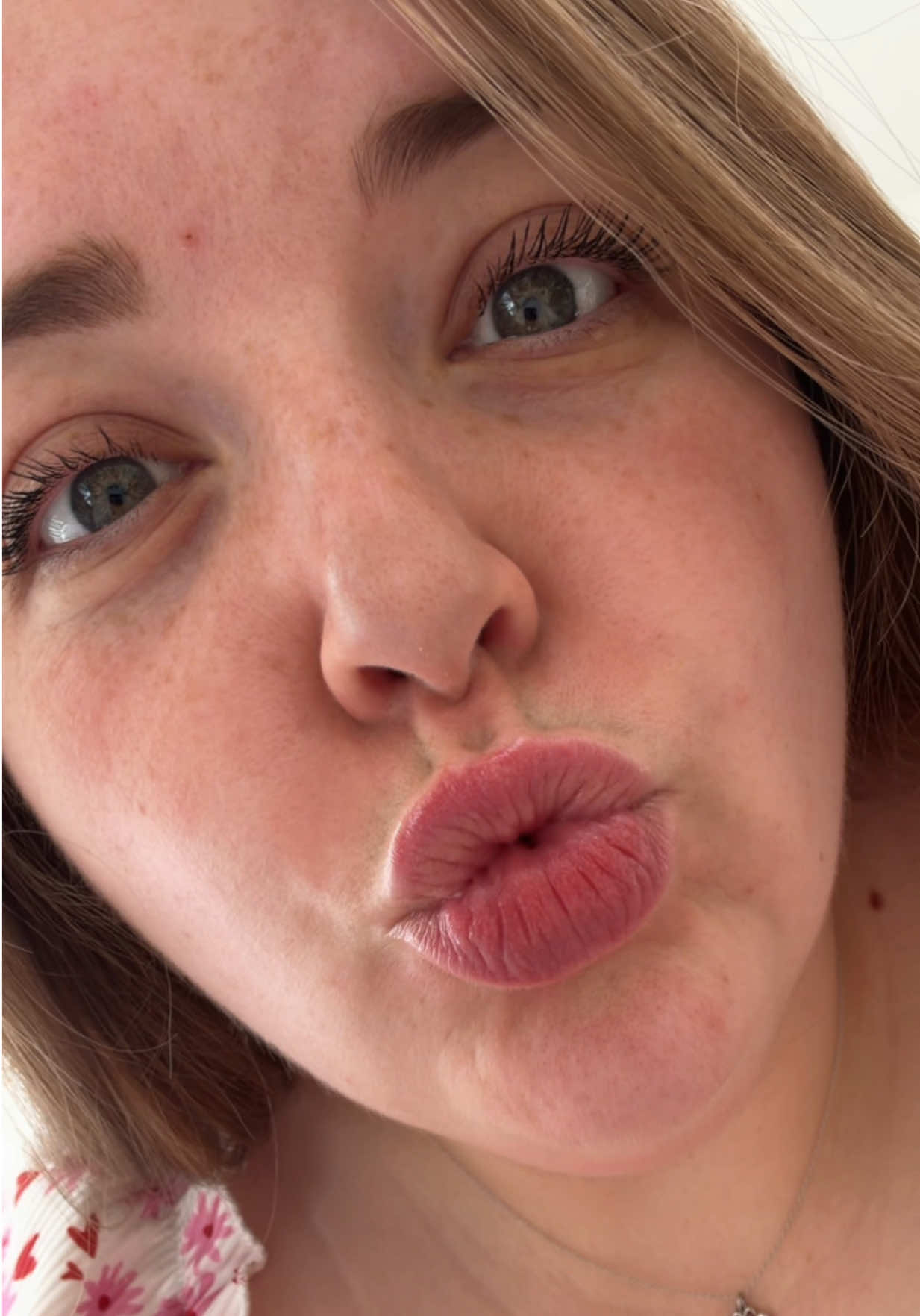 @Amber Louise ๐