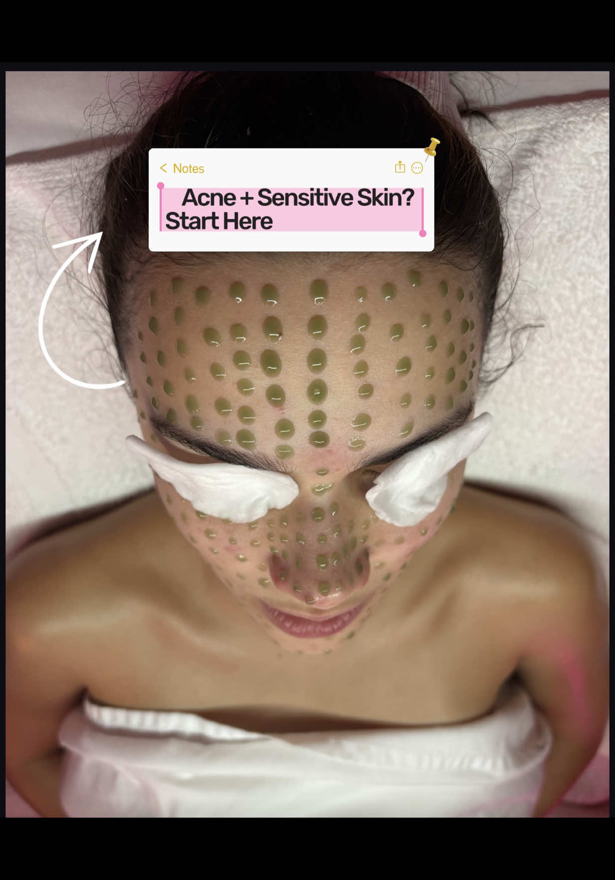 @HappySkinBySara