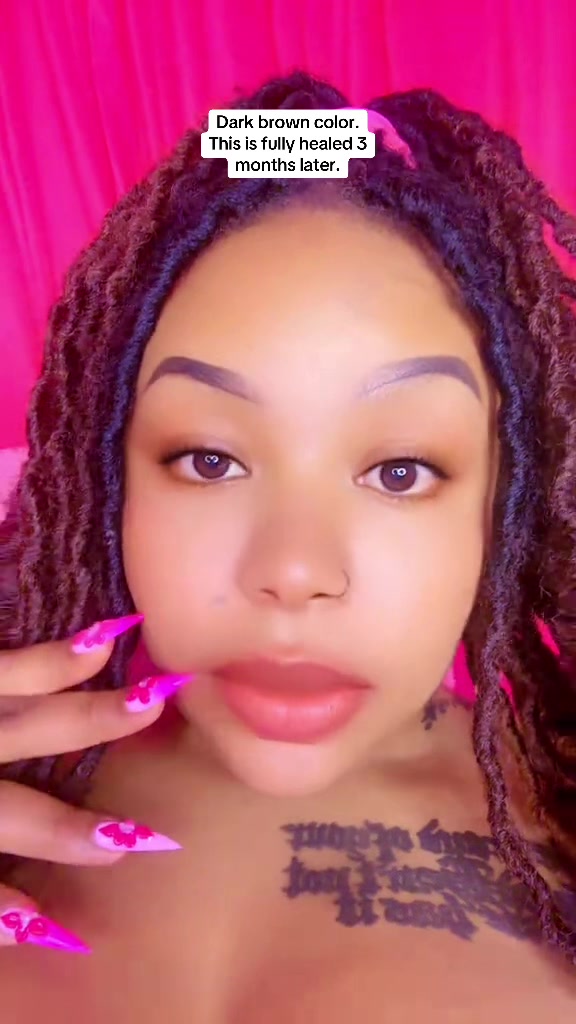 @Dr.eyebrows1