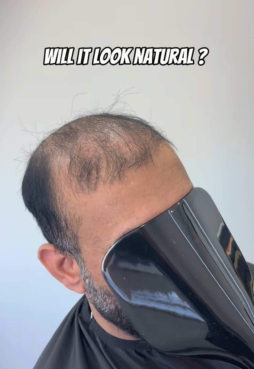 @josh_hair_systems