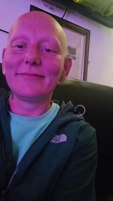 @baldies_adventures