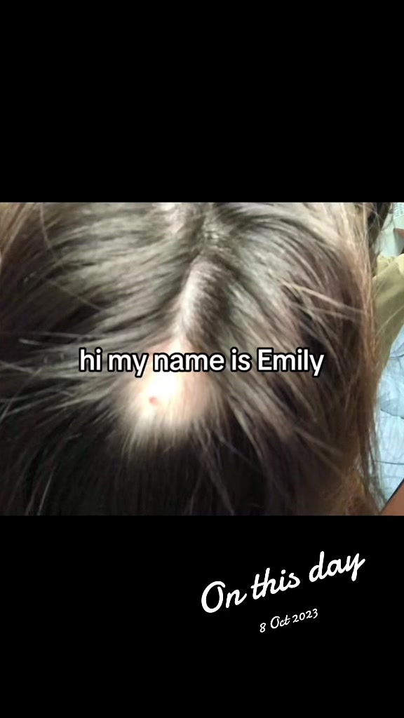@Emily