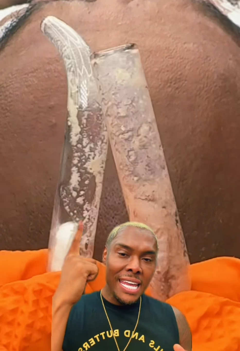 @Ronnie