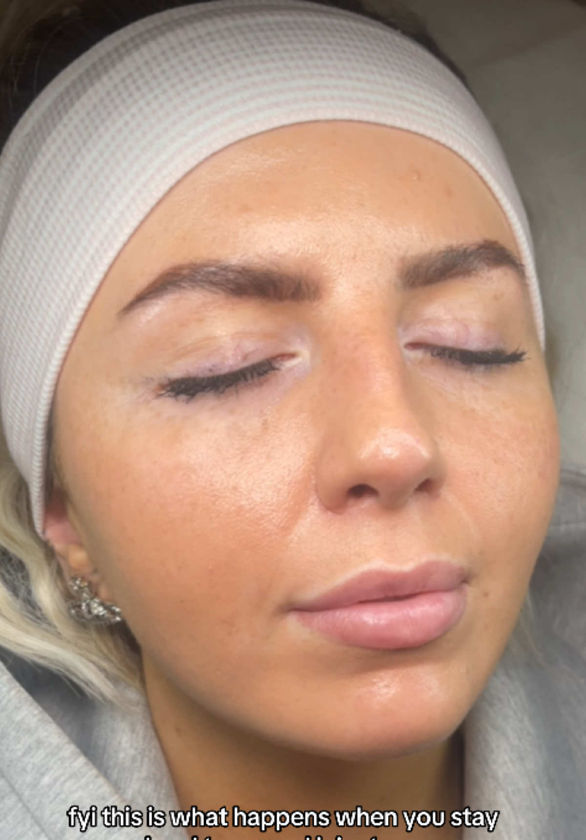 @clubskinuk