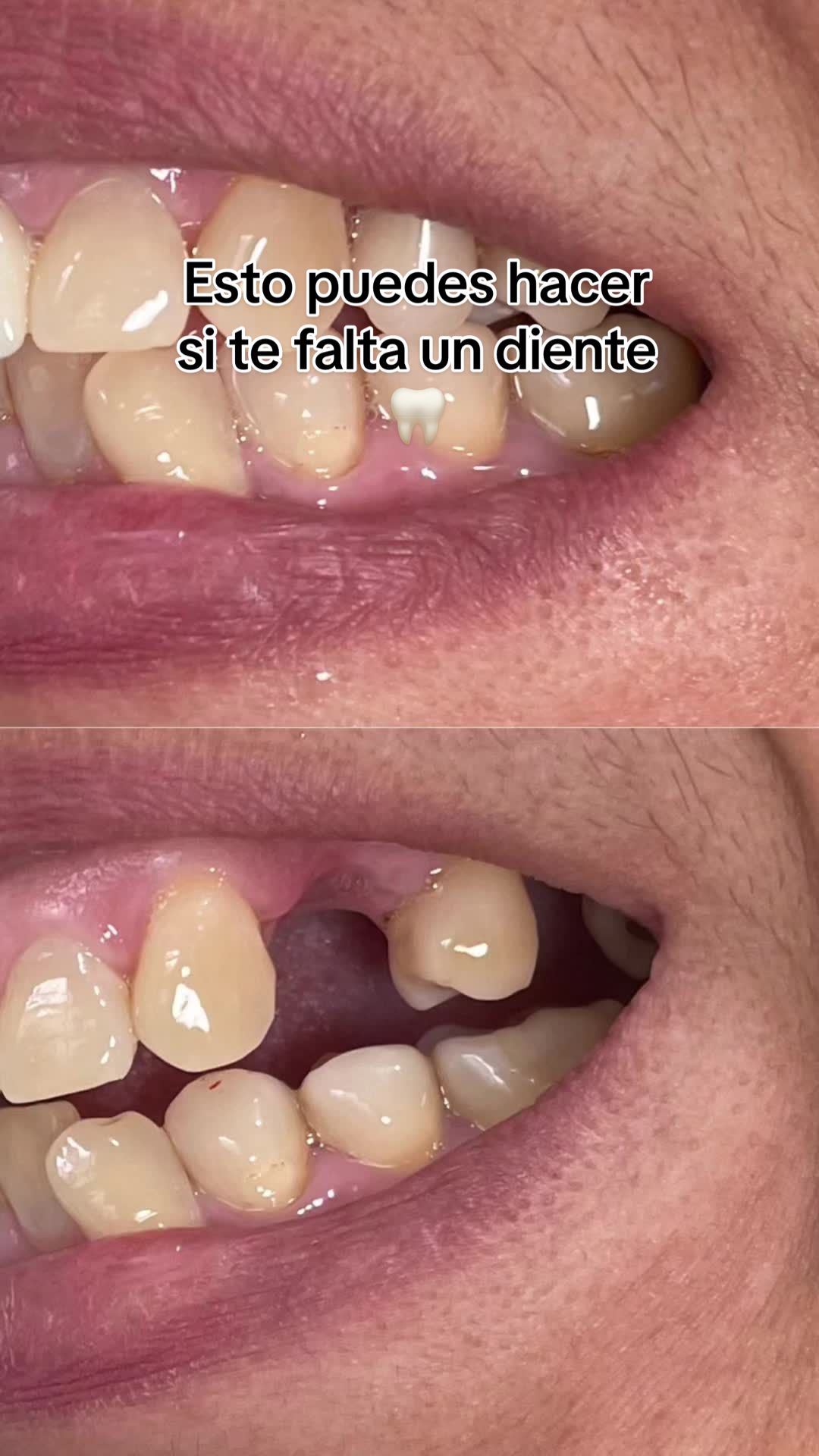 @ARMONI DENT