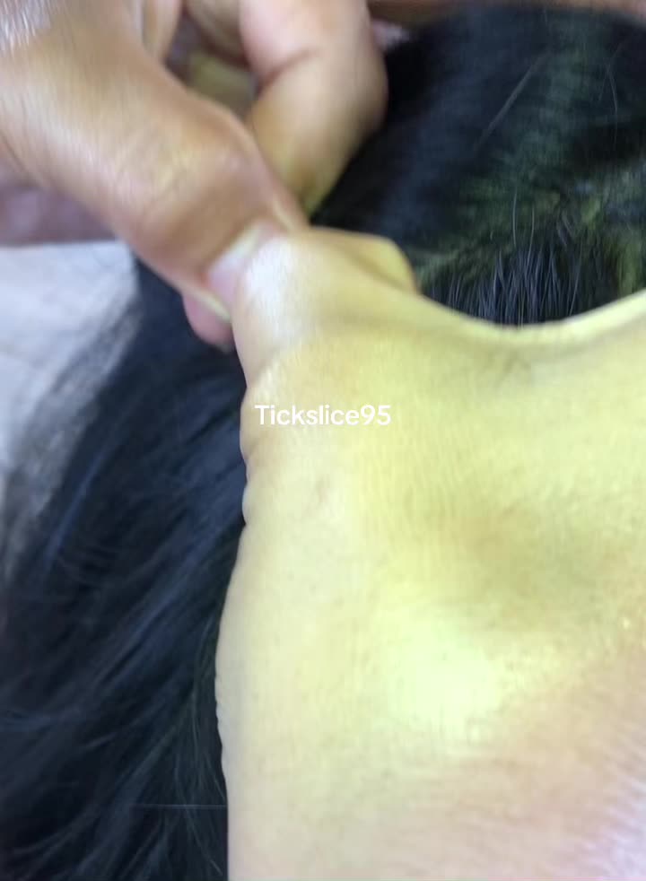 @Tickslice95