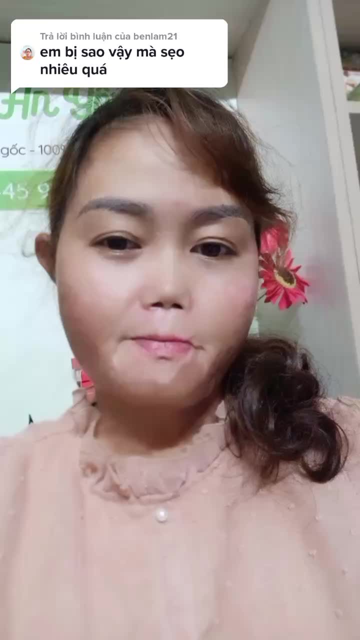@Ng&acirc;n An Y&ecirc;n