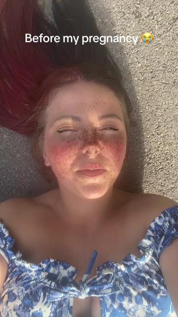 @WelshPsycho18