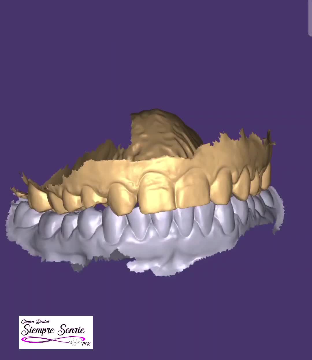 @Siempre Sonr&iacute;e Cl&iacute;nica Dental