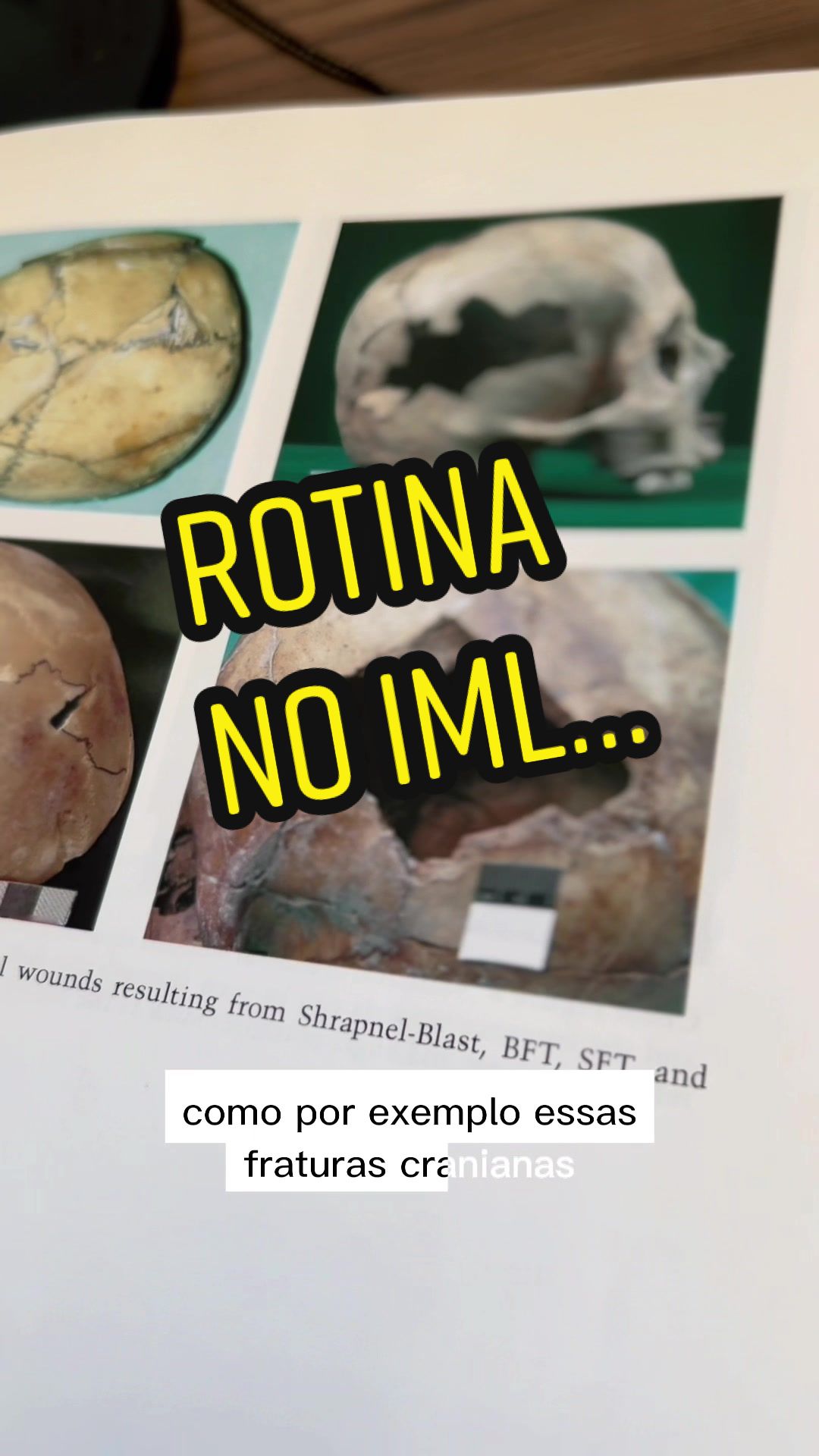 @Marcelo Rocha Campos