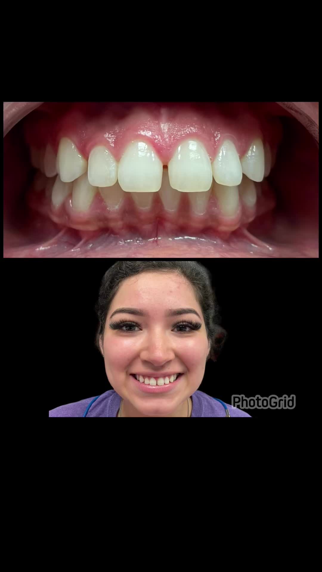 @ZivaDental🦷🪥