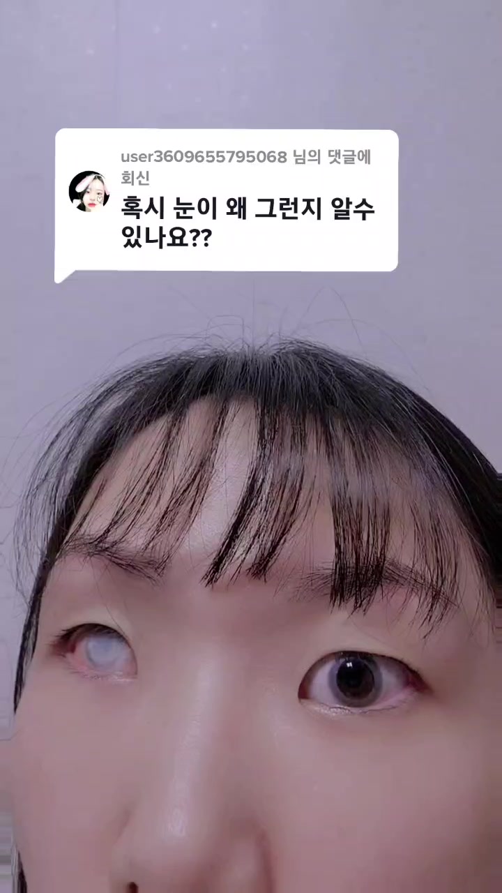 @희안한 회안Gray eye