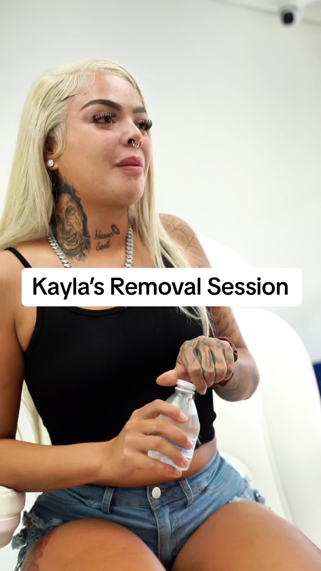 @@BHLASERTATTOOREMOVAL