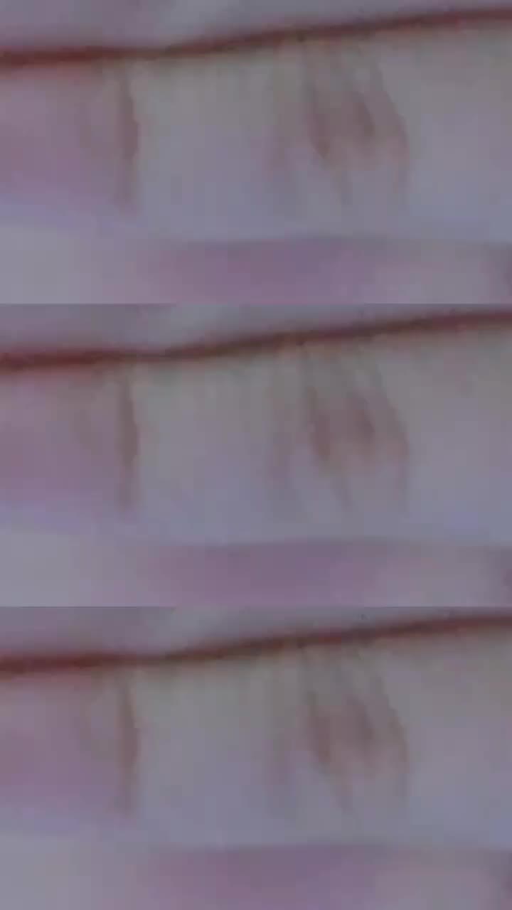 @์งํ๋โก๐