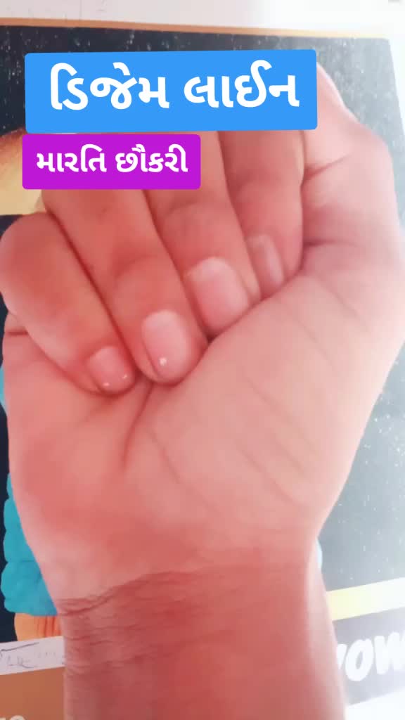 @Kiran Zala310