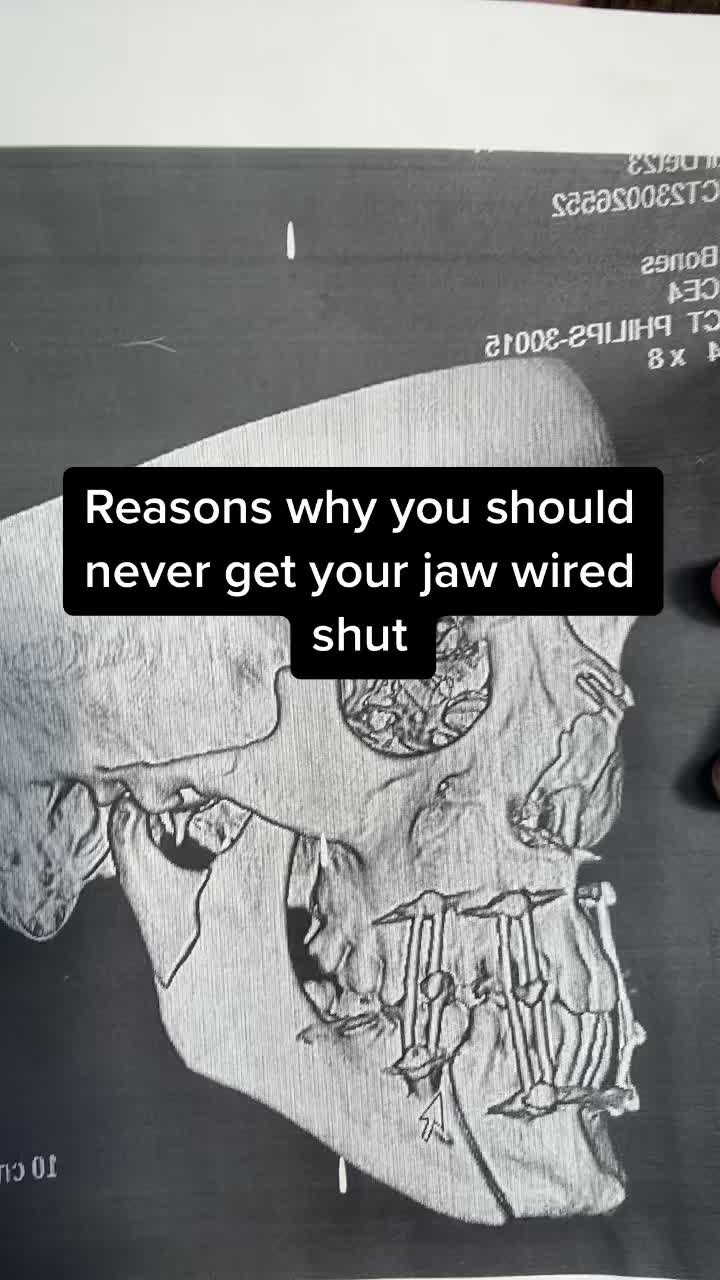 @Medium Boy