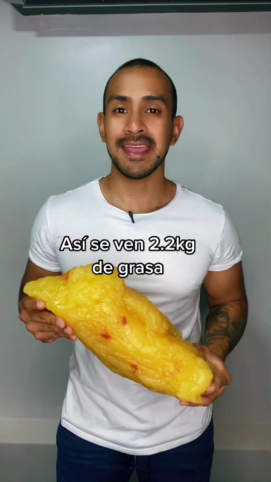 @Leonardo Rocha