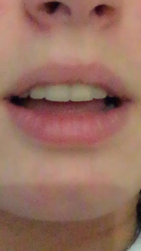 @Shxnix.pov