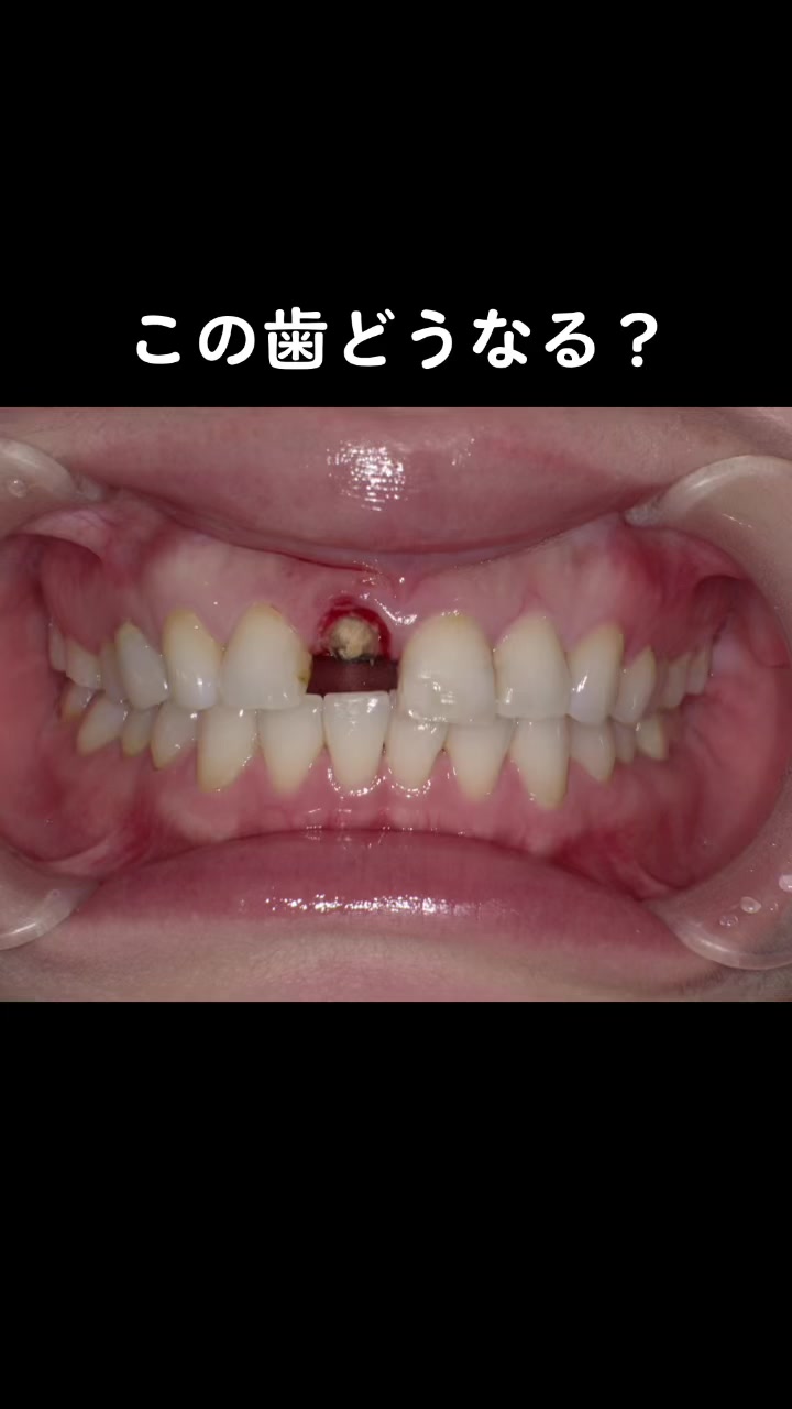@DentalClinicPURE