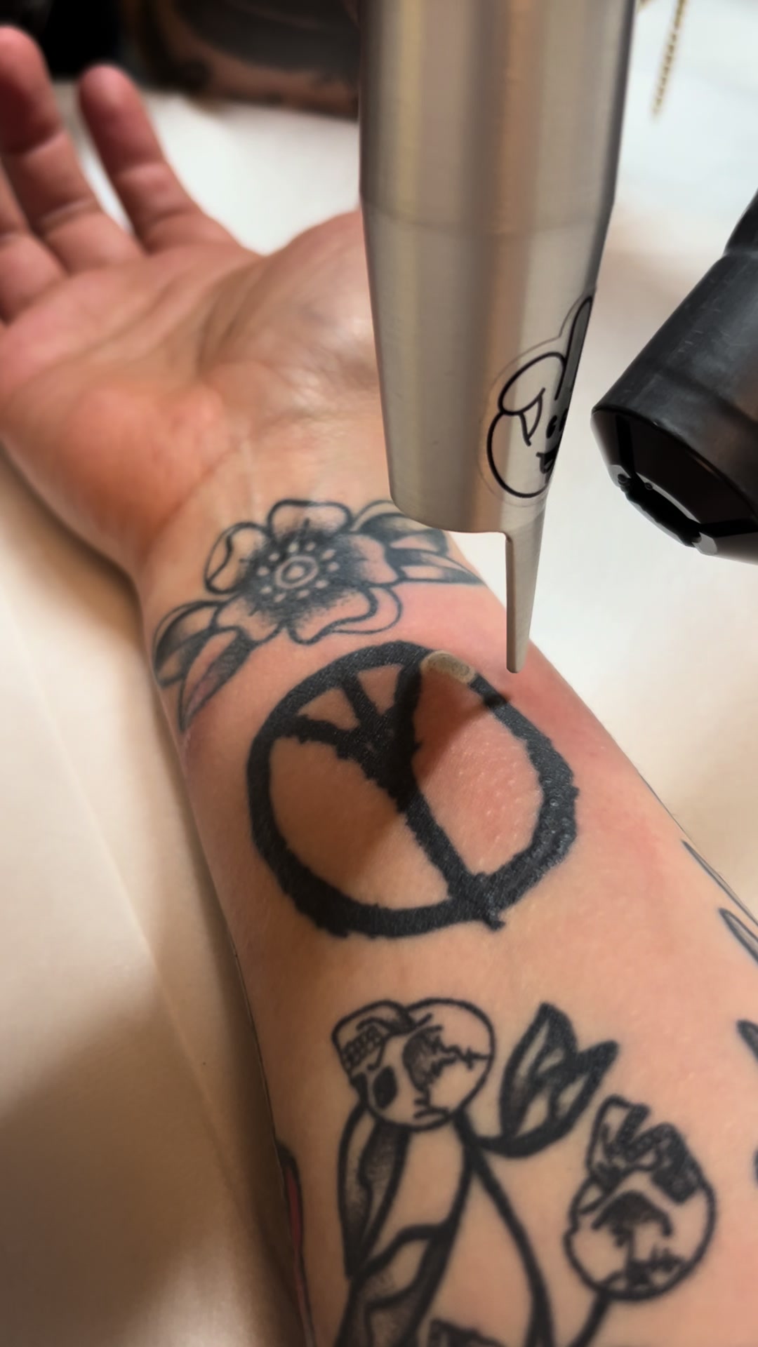 @Swift_tattoo_removal