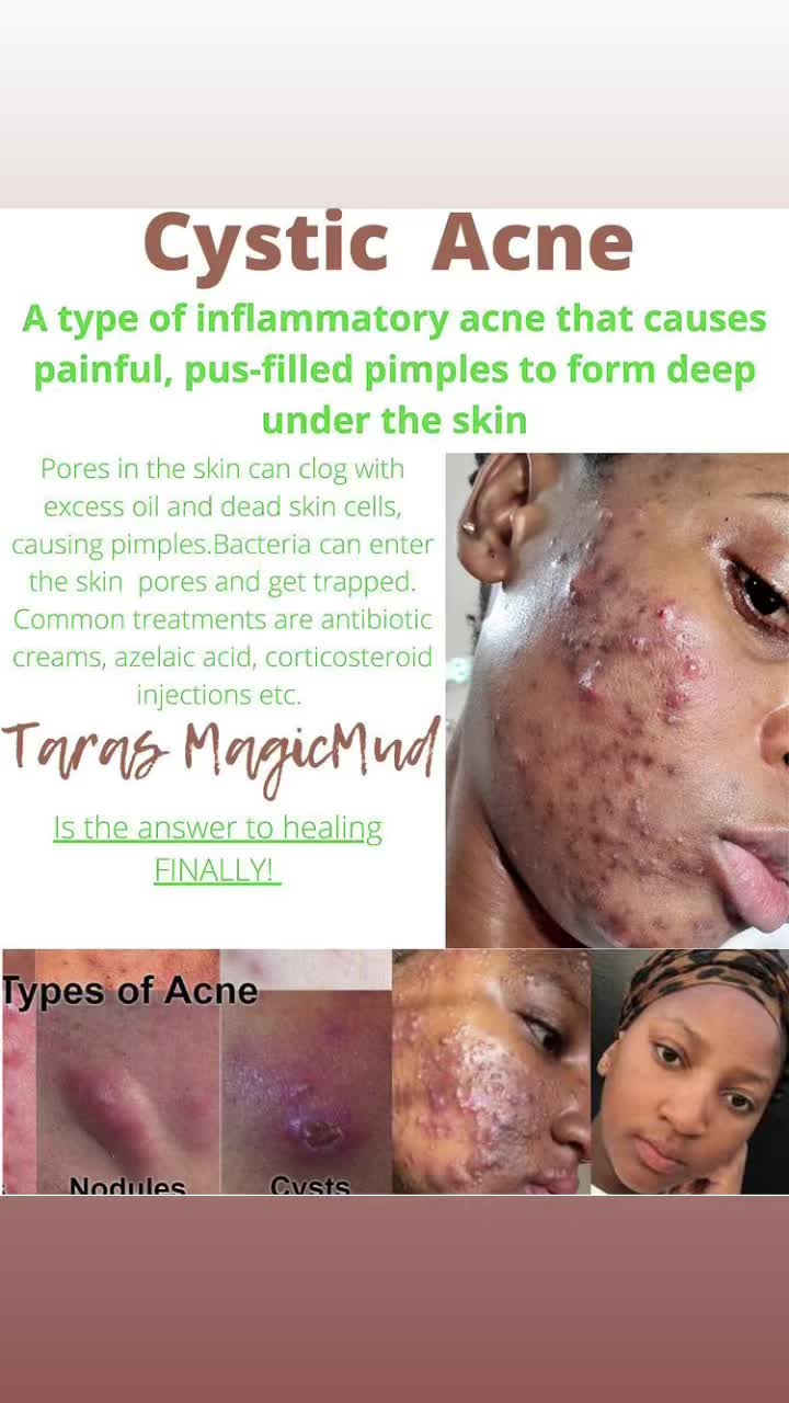 @tarasmagicmud