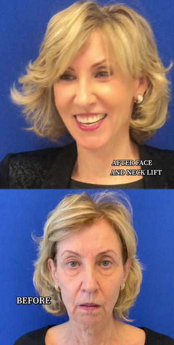 @Dr. Maia | Plastic Surgeon