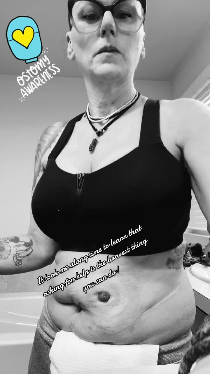 @IleostomyWarrior.Sher