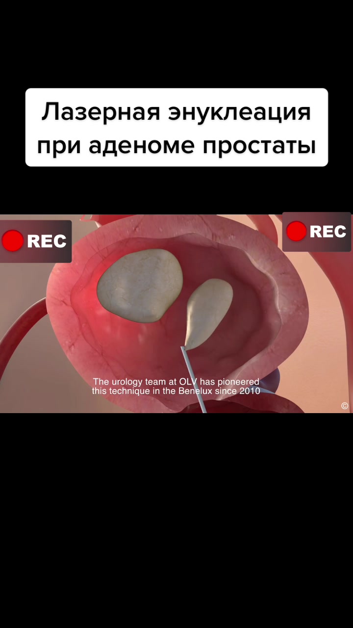 @Denis Davydov