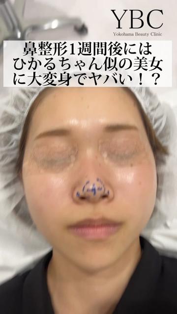 @イソセン/美容外科医（磯村亮輔院長）