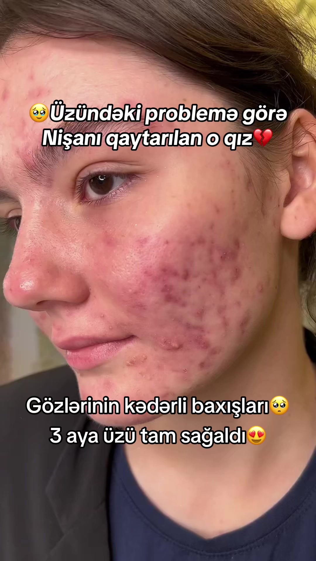 @✨Dr.AmrahMehdiyev
